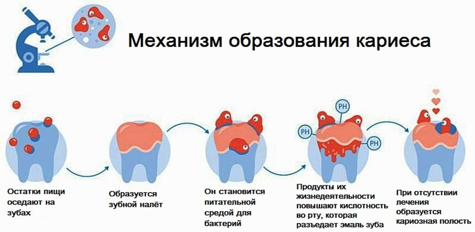 Кариес причины возникновения. Механизм возникновения кариеса зубов. Факторы возникновения кариеса зубов. Патогенез развития кариеса. Резистентность эмали