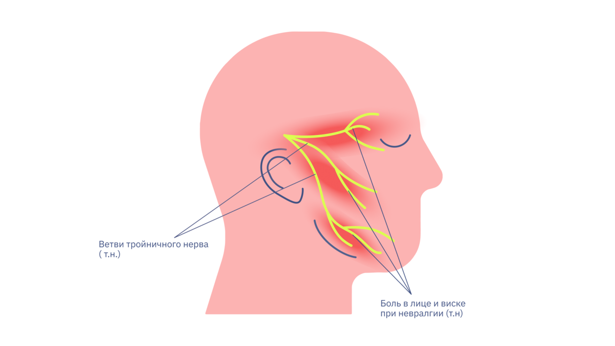 Тройничный нерв. Ветви тройничного нерва на лице. Ветви тройничного нерва анатомия. Раздражение нерва.