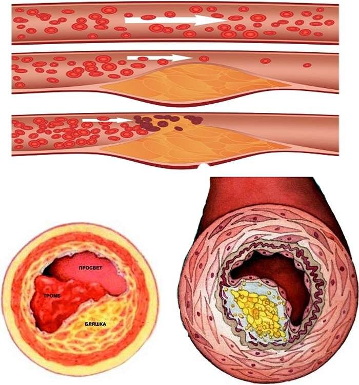 Кровяносные сосуды человека 