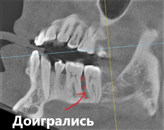 Просто "отлично".