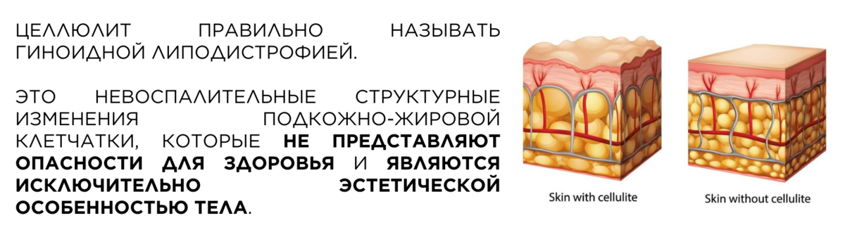 Информация, которая поможет вам выбрать лучший способ как избавиться от целлюлита