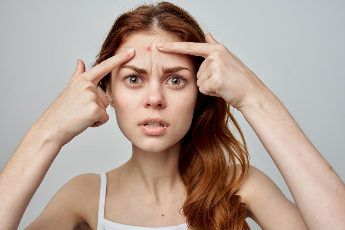    К чему снится прыщ 123RF/legion-media.ru