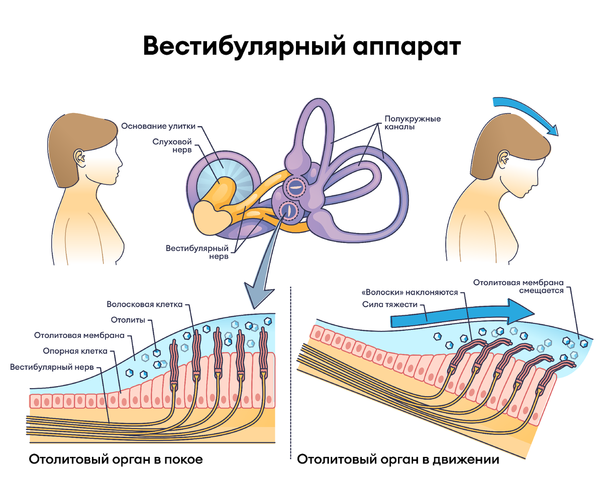 Вестибулярный нейронит: симптомы и лечение | Клиника Рассвет