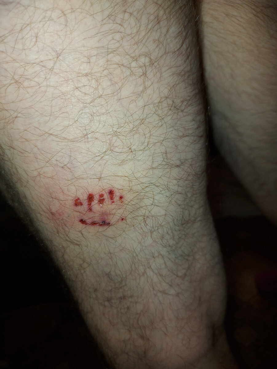 Нога не моя! 😉