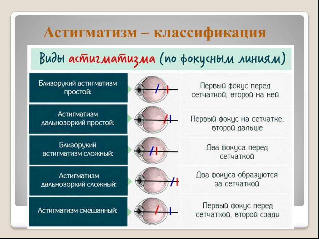 Изображение при астигматизме рассматриваемого предмета