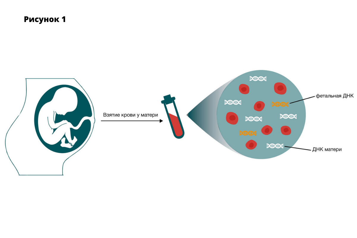Неинвазивный пренатальный тест (НИПТ) | Медицинский центр «Нью-Медика» |  Дзен