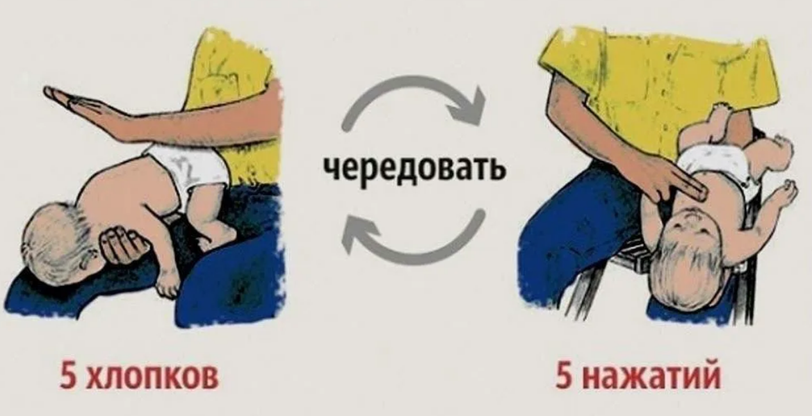 Что делает прием. Приём Геймлиха у детей до года. Ребенок подавился прием Геймлиха. Прием Геймлиха детям до 1 года. Оказание первой помощи если ребенок подавился и задыхается видео.