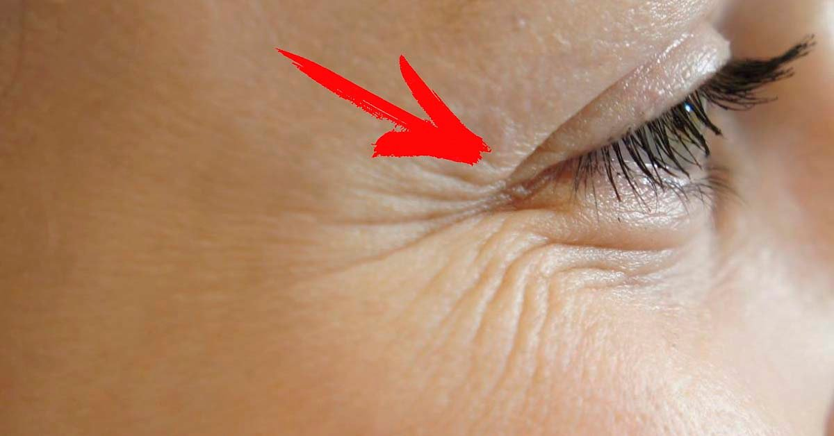Woman face before and after cosmetic procedure. Plastic surgery concept. фотогра