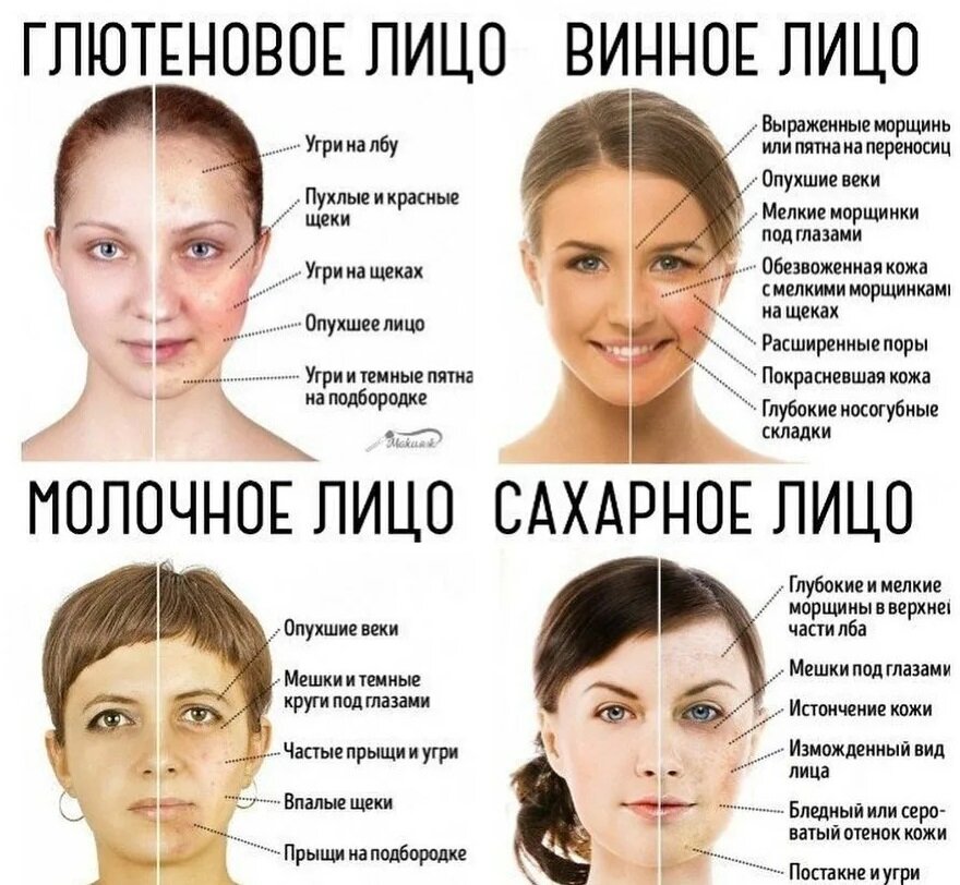 Как выглядит сахарное лицо