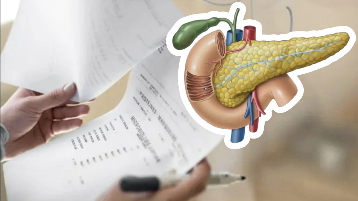 Зашалила поджелудочная — рискуете заработать диабет. Какие анализы ...