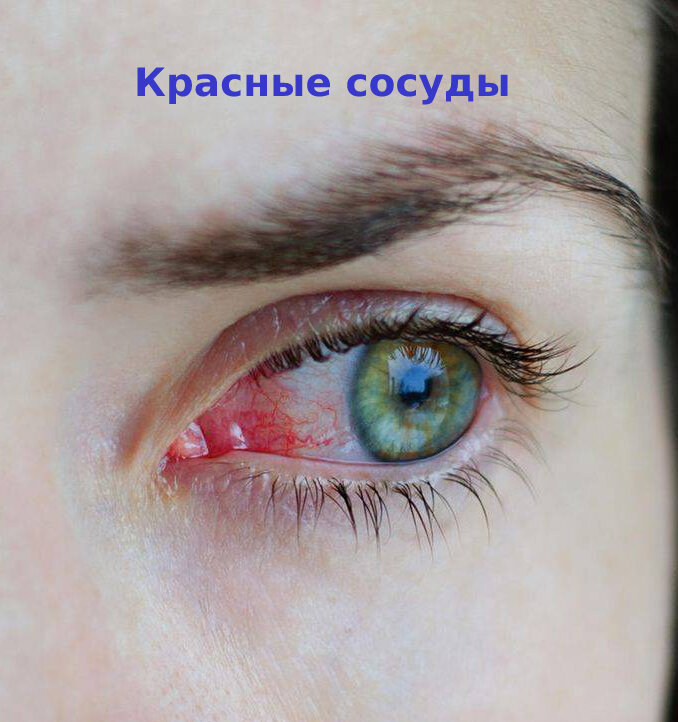 Красные глаза