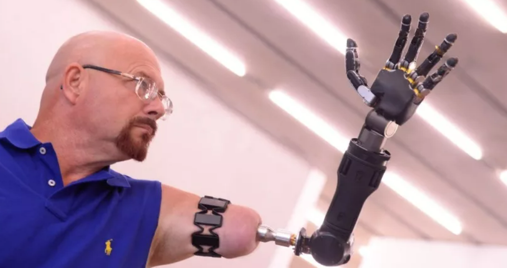 Robotic limbs. Бионический протез руки Джона Хопкинса. Джесси Салливан бионические протезы. Бионический протез Манифесто. Бионический протез Bionic