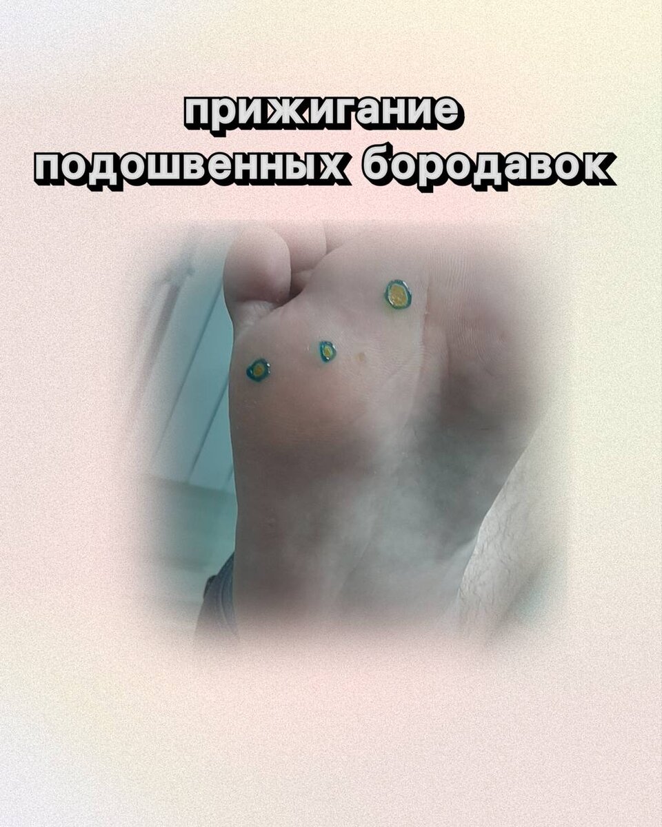 Клиника подологии в Волгограде предлагает индивидуальный подход к каждому клиенту, чтобы достичь наиболее эффективного результата.