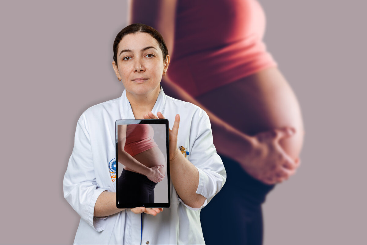 проктологические заболевания после родов. наружный геморрой при беременности 3 триместр. внешний геморроидальный узел. лечение геморроя у женщин после родов при грудном вскармливании. геморрой в 3 триместре беременности.