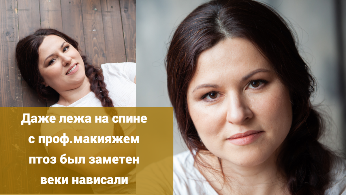 Даже телевизионный визажист и профессиональный фотограф не смогли замаскировать всех складок, бугров и обвинений. 