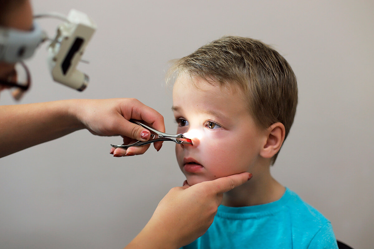 Стандартный осмотр носа. Так аденоиды увидеть нельзя. Фото из открытых источников