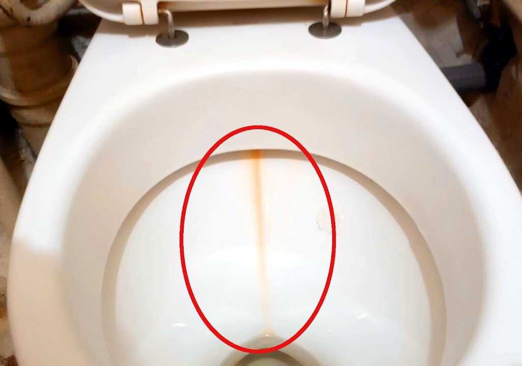 Регулярная уборка туалета необходима не только по гигиеническим, но и по эстетическим причинам. Вид известкового налета в унитазе прямо-таки отталкивающий.