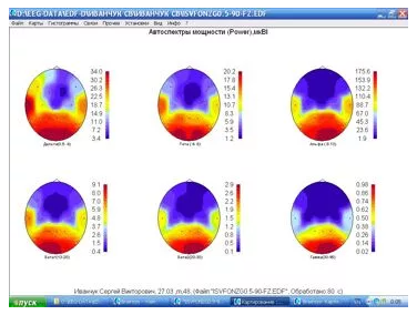 Рис.1. Графическое изображение поверхностей мозга (лоб сверху, затылок снизу) с распределением спектральной мощности ритмов в диапазонах частот, указанных снизу. Справа от каждой поверхности цветовая шкала уровней мощности в мкВ2.