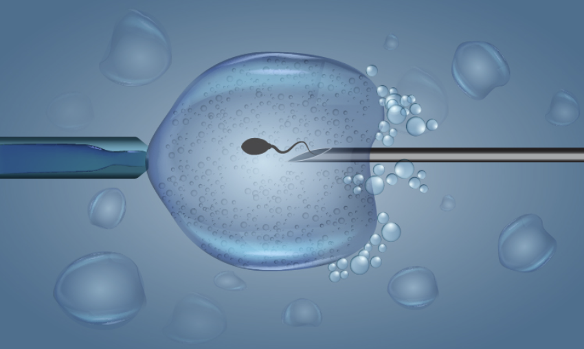 Инсеминация in vitro. Искусственное осеменение. Эко икси москва. Эко это искусственное оплодотворение. Инсеминация in vitro.