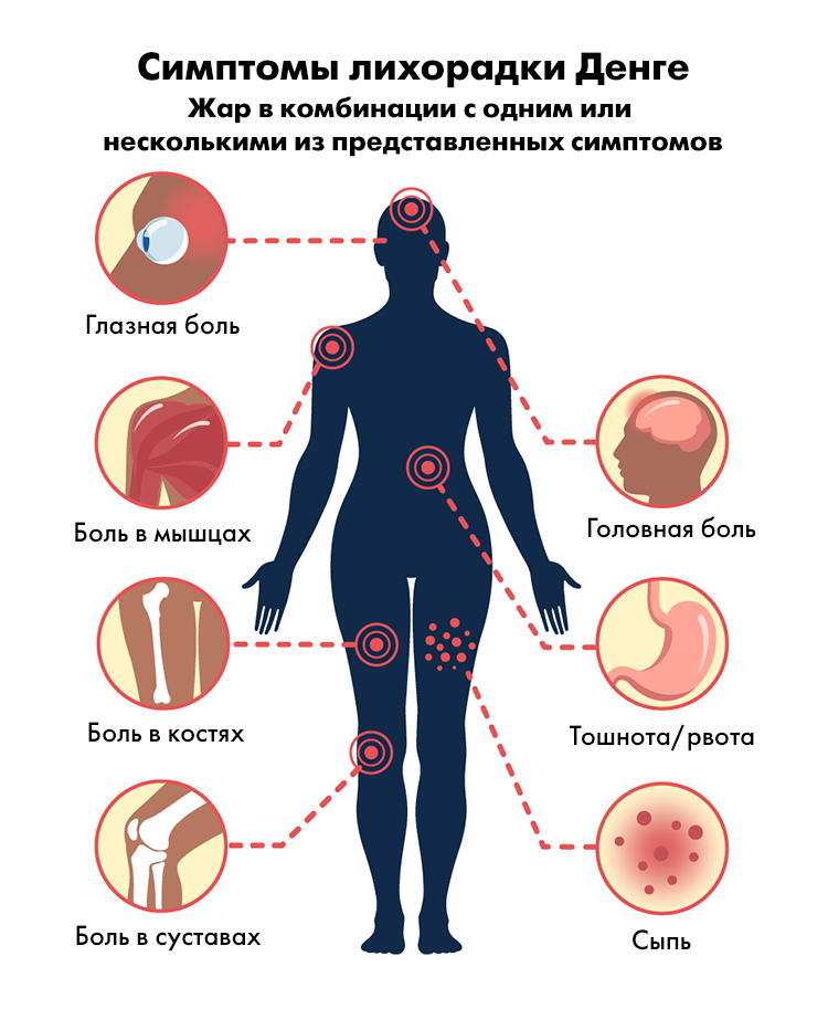 Лихорадка денге в Пакистане