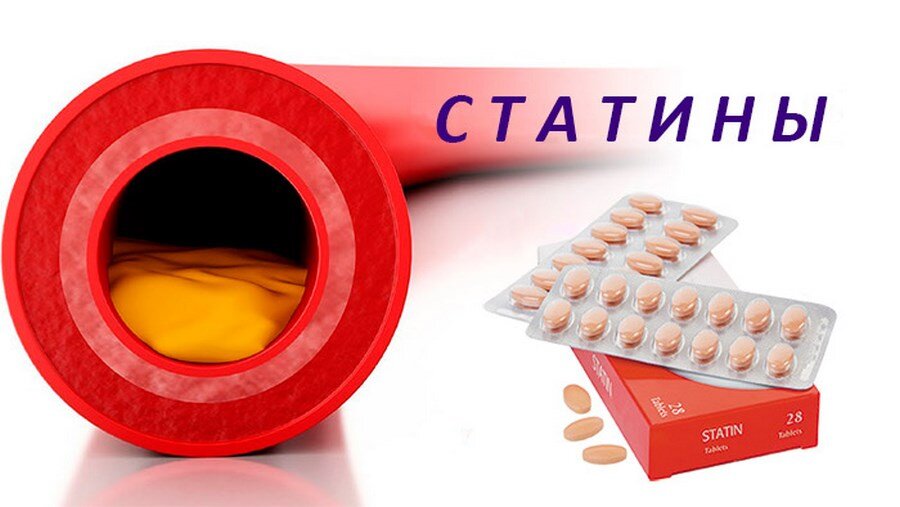 Статины - препараты, которые назначаются для снижения уровня холестерина. Это - важные препараты, которые уменьшают риск возникновения инфаркта миокарда и инсульта.