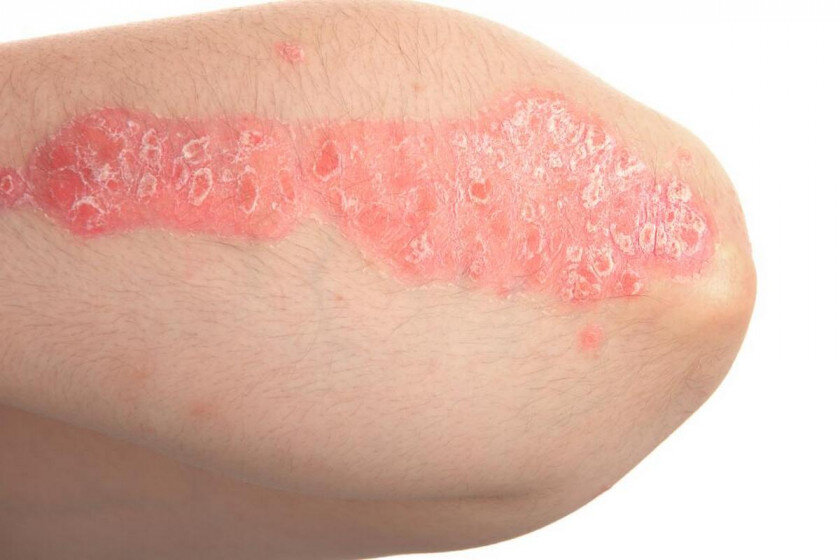   petekarici, istockphoto