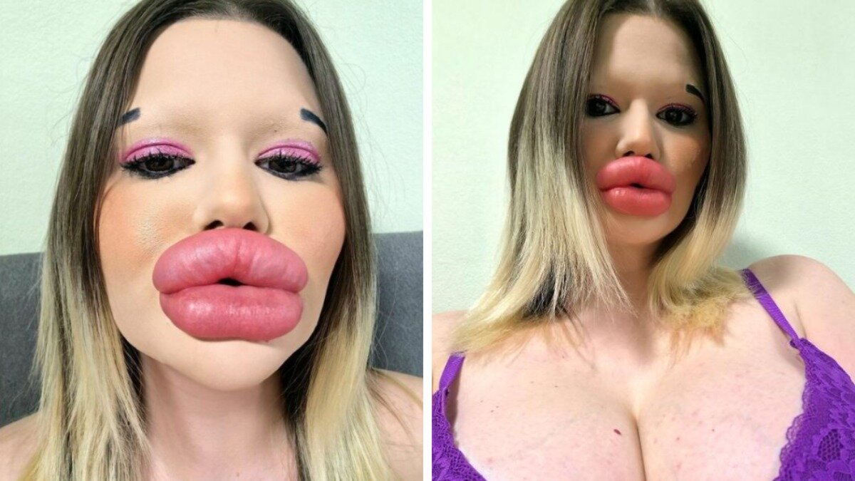 Женщина с самыми большими губами в мире решила найти мужчину. Назвала главное требование — Фото