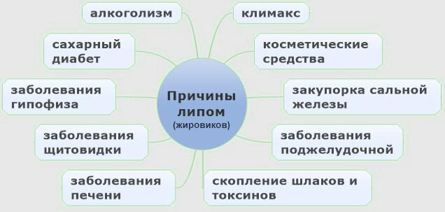 Липомы - причины, симптомы, диагностика, лечение и профилактика заболевания