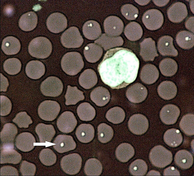 Анаплазма фагоцитофилум (Anaplasma phagocytophilum)