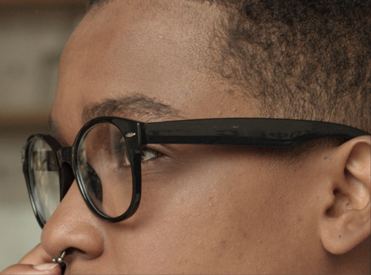 над дужкой очков в височной области и на скуле разница особенно заметна