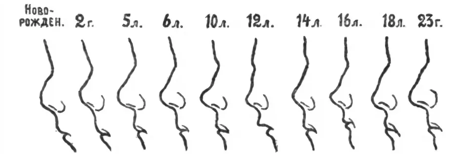 Вырасти по лицам. Как меняется форма носа с возрастом у подростков. Как меняется форма носа у детей с возрастом. Изменение носа с возрастом. Изменение формы носа с возрастом.