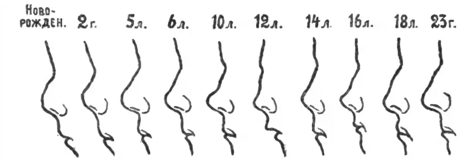 До скольки растет нос. Как меняется форма носа с возрастом. Как меняется форма носа у детей с возрастом. Изменение формы носа с возрастом. Форма носа меняется с возрастом.