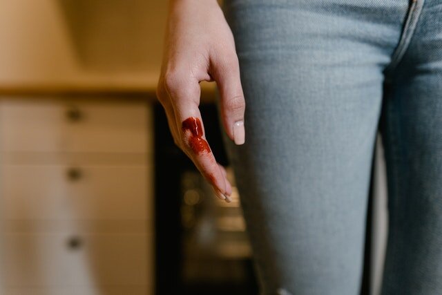 Кровь на руках. Фото: pexels.com