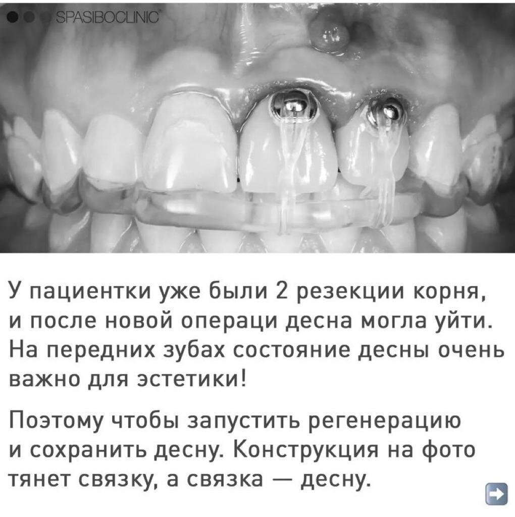 БОЛЬШАЯ КИСТА: ЛЕЧЕНИЕ | Спасибо.Клиник | Дзен