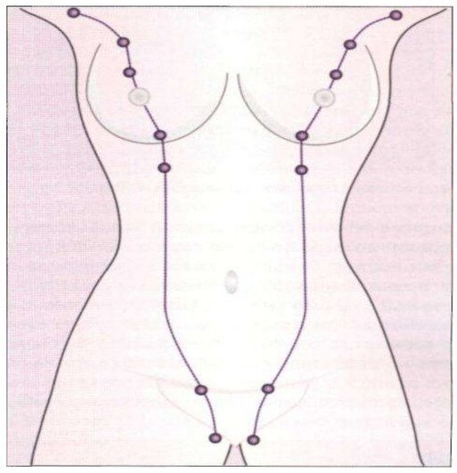 Молочные линии с зачатка и молочных желез. 