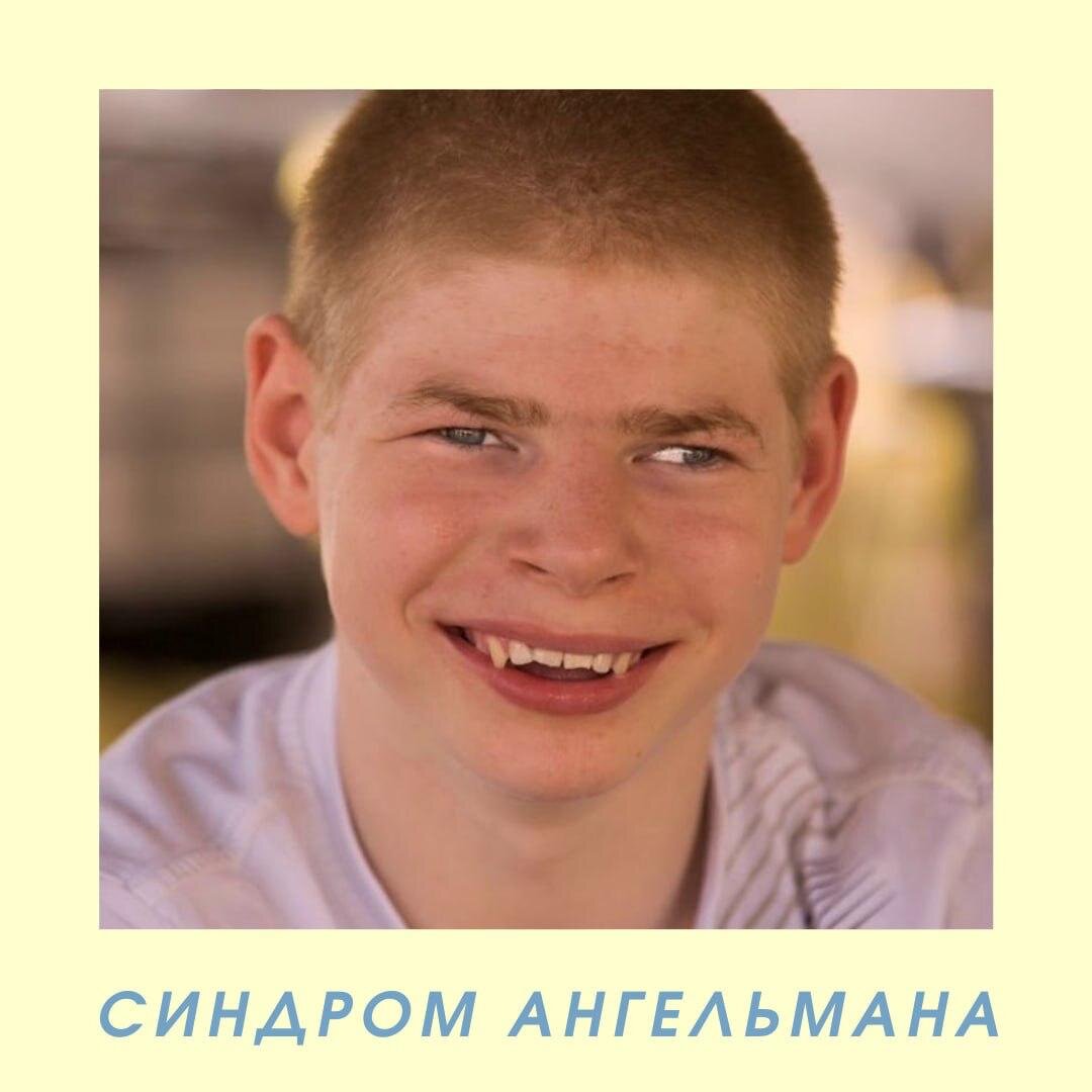 СИНДРОМ АНГЕЛЬМАНА | Центр Неврологии и Педиатрии | Дзен