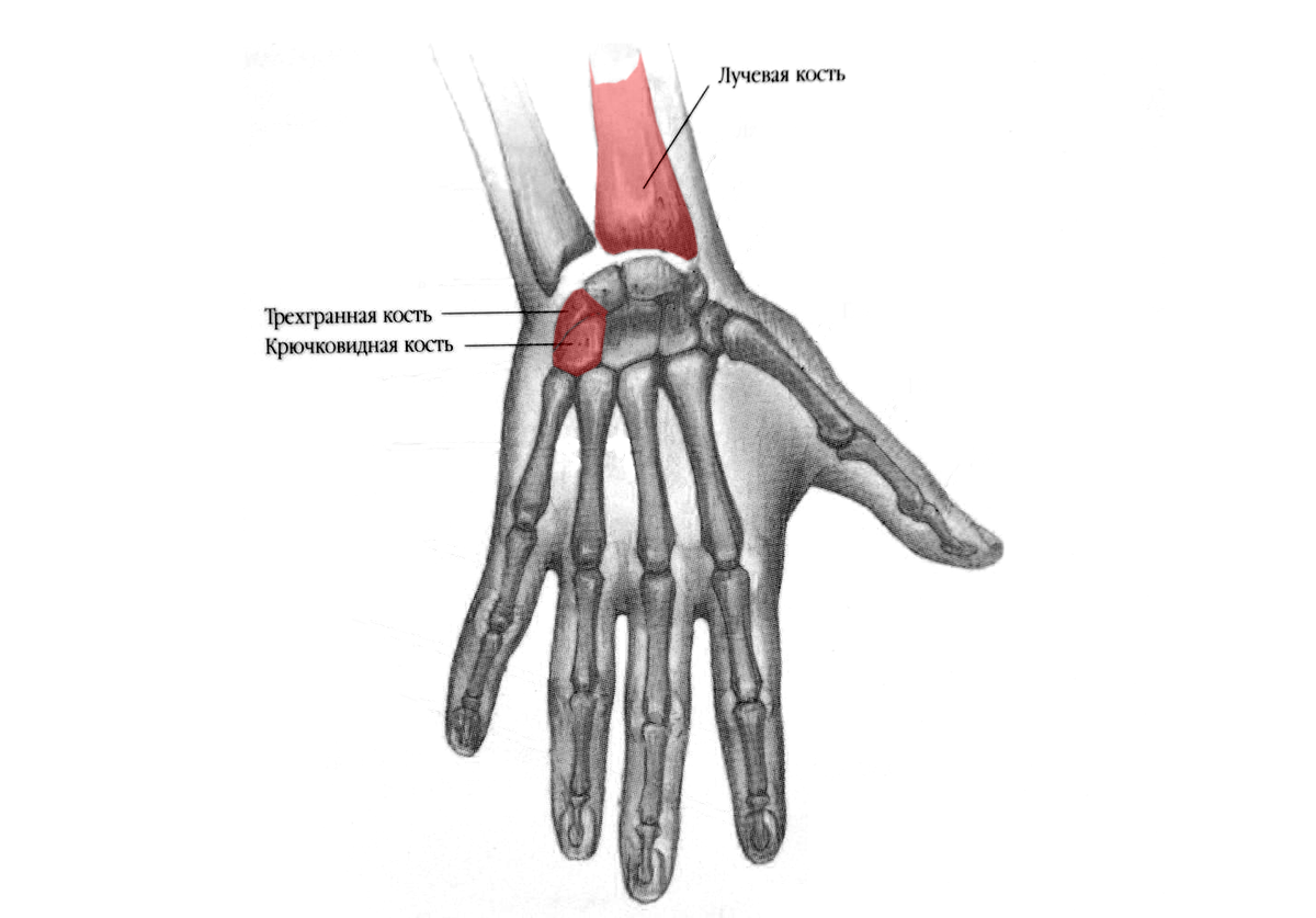 Тру косте. Перелом Трехгорбой кости кисти. Перелом крючковидной кости кисти. Кости запястья гороховидная кость. Перелом трехгранной кости запястья.