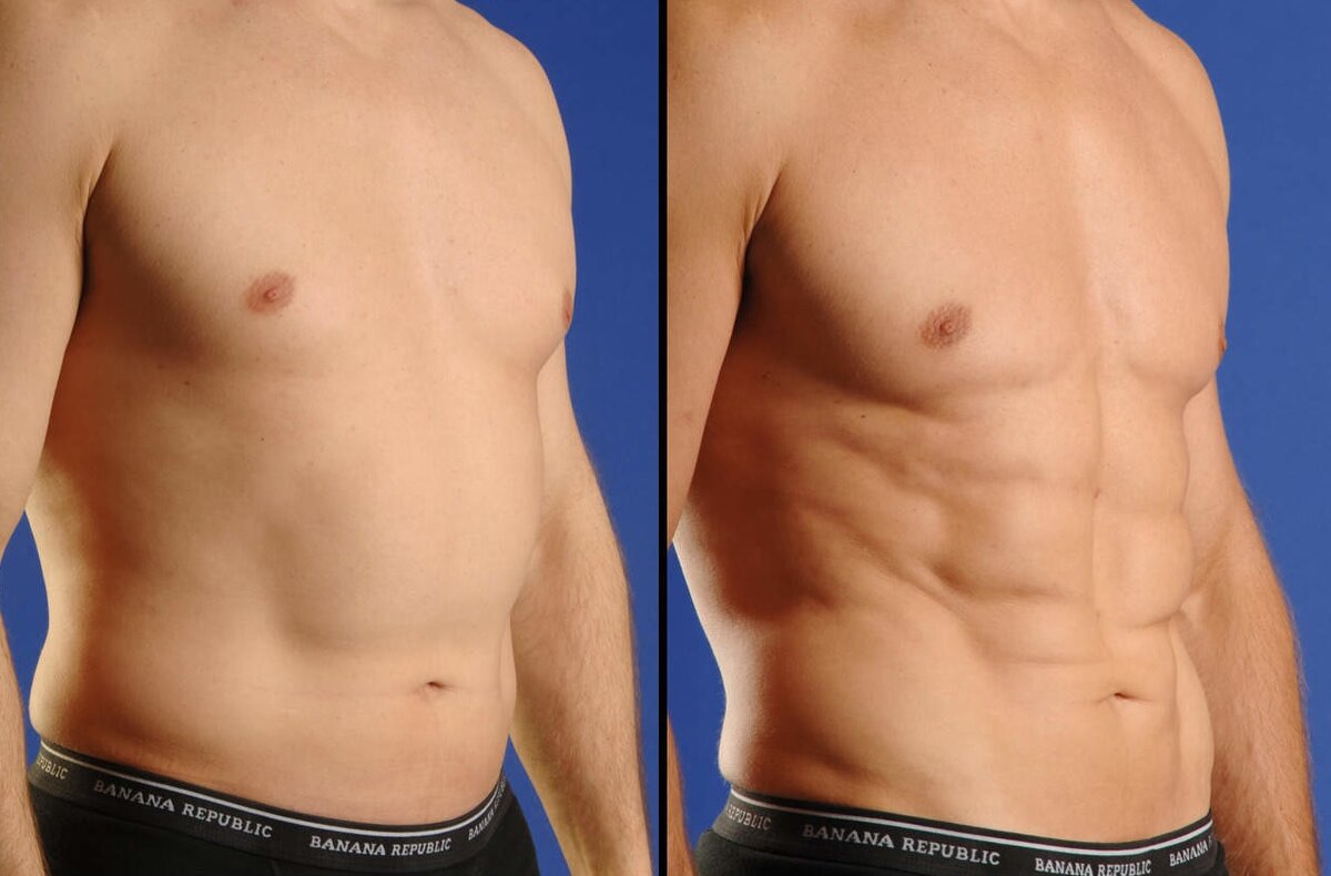 Имплантация мускулов выглядит неестественно.