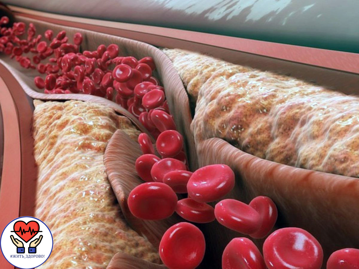 Фото с сайта im30.clum