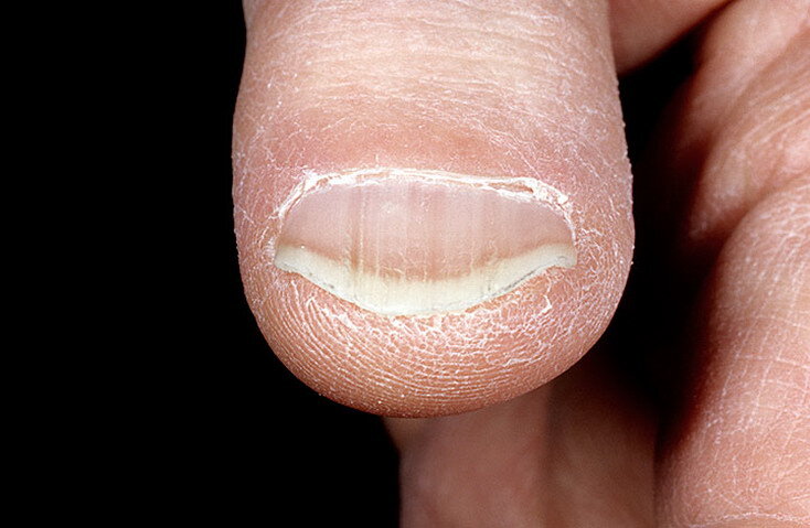 Колойнихии. Фото взято из сторонних источников.