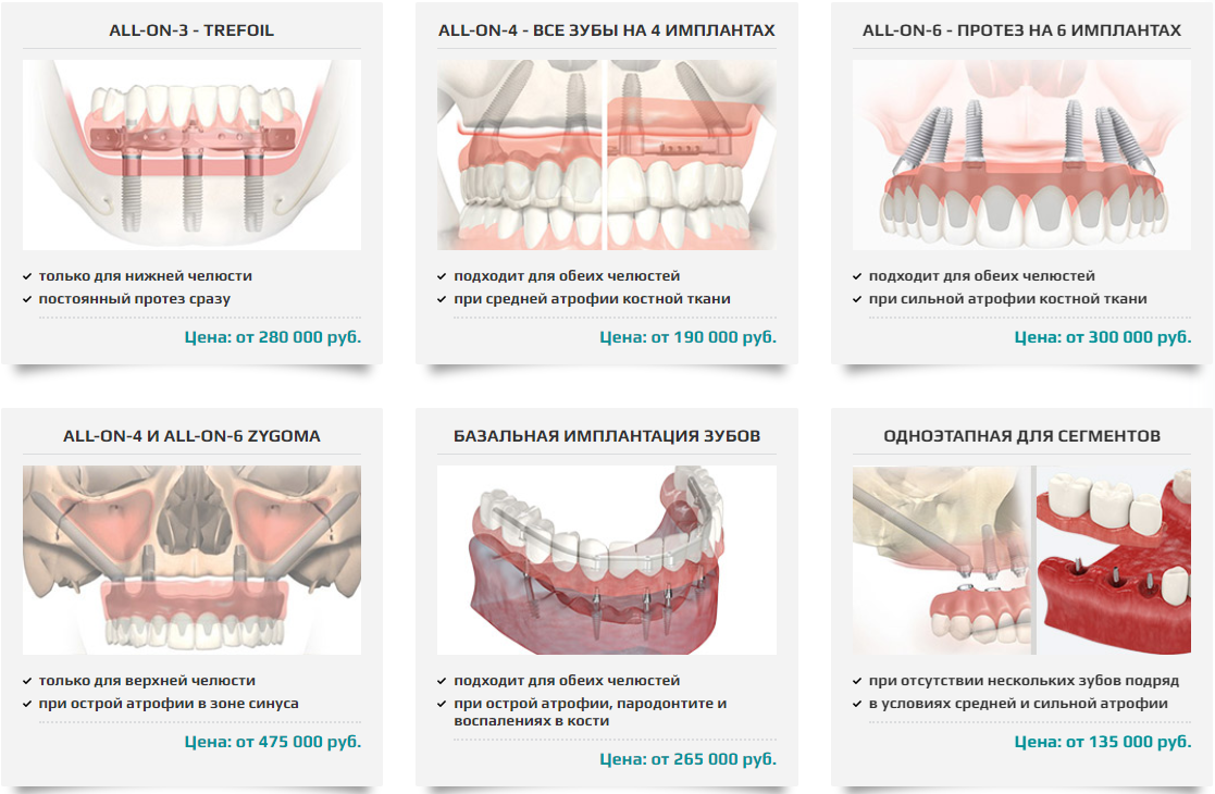 Что нельзя делать после установки. Способы имплантации зубов. Способы дентальной имплантации. Протоколы имплантации зубов. Этапы имплантации зубов.