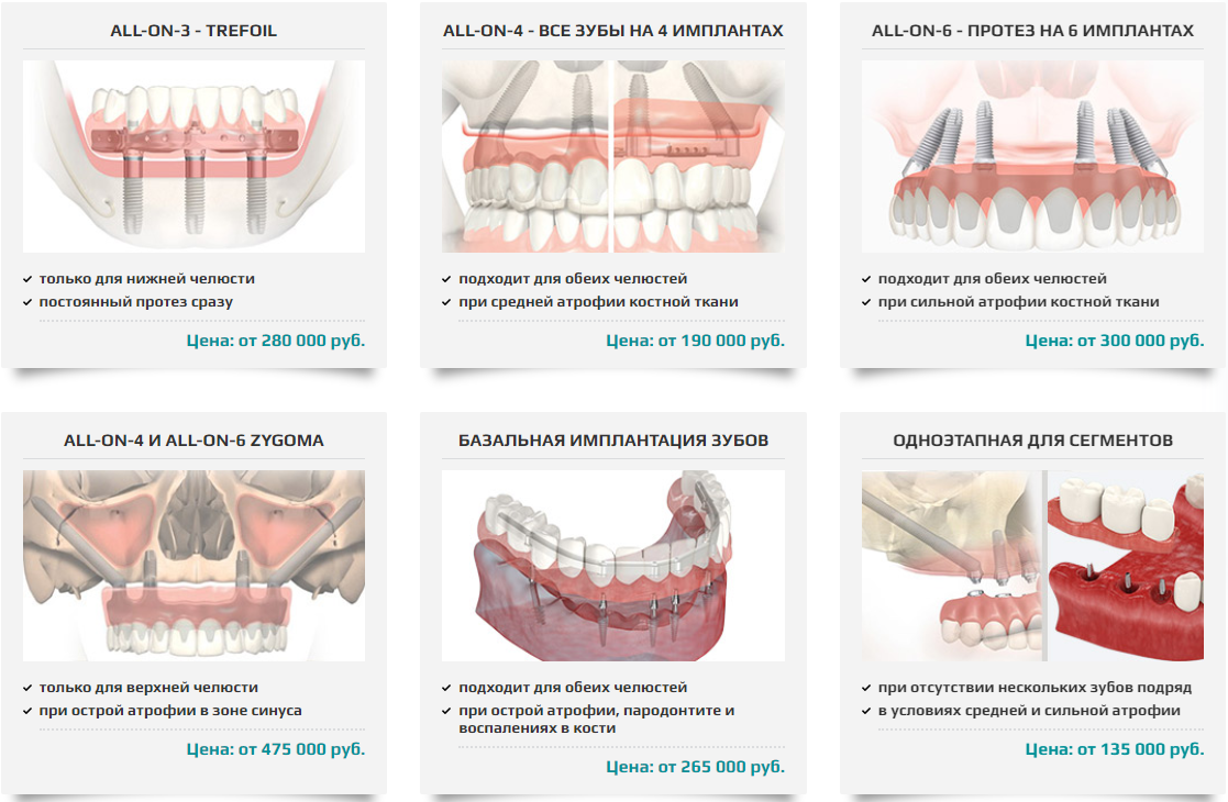 Импланты отзывы пациентов. Дентальная имплантация хирургический протокол. Имплантация зубов протоколы. Имплантация нескольких зубов. Брошюра по протезированию на имплантатах.