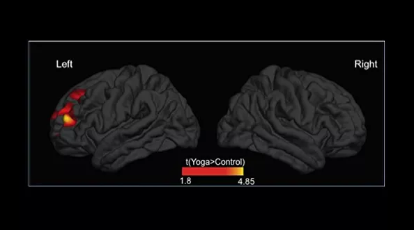 Слева — мозг женщины, практикующей йогу, справа — участницы контрольной группы. Цветом выделены участки префронтальной коры, которые у любительниц йоги оказались толще