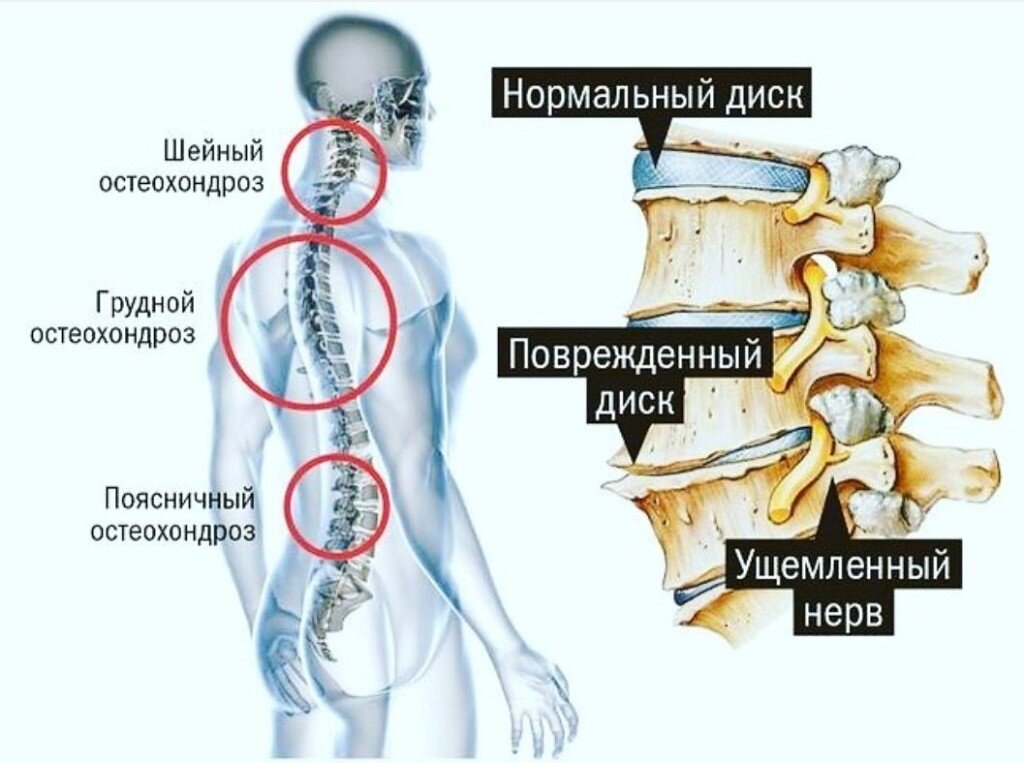 Комплекс упражнений для снятия напряжения с мышц спины. Занятия на коврике помогут снять напряжения с основных мышечных…