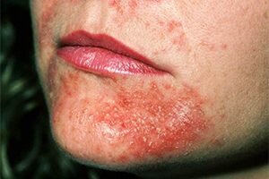 Фото из интернета, один в один как у меня