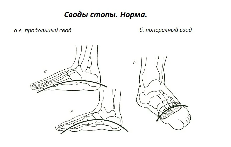 Продольный поперечный свод