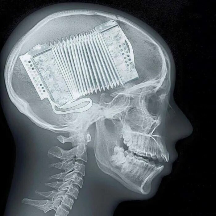 Из открытых источников. 