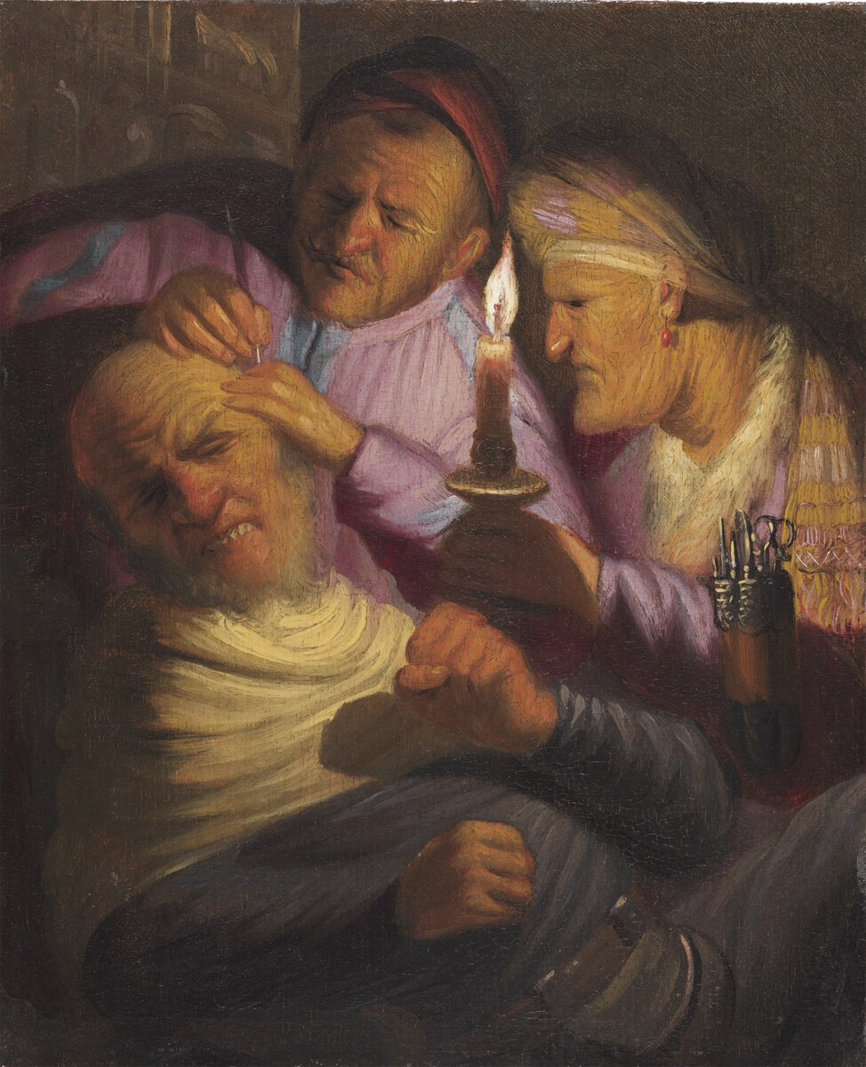 Операция по извлечению камня. Аллегория осязания из серии "Пять чувств"