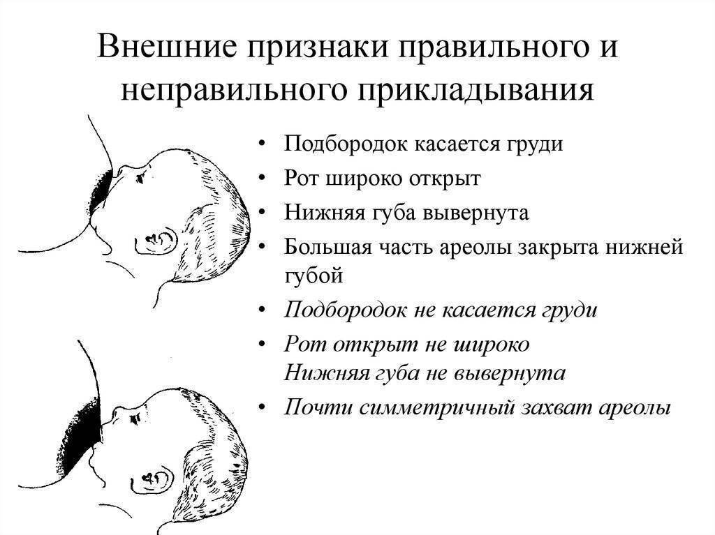 Нужно ли прикладывать. Техника прикладывания ребенка к груди. Вскармливание новорождённого.. Как правильно прикладывать ребенка для кормления новорожденного. Правильное прикладывание новорожденного к груди. Как правильно приложить ребенка к грудному вскармливанию.