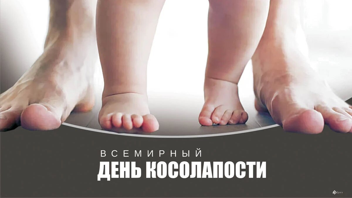 Всемирный день косолапости. Иллюстрация: «Курьер.Среда»